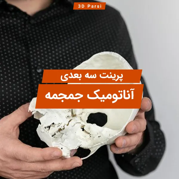 پرینت سه بعدی آناتومیک جمجمه