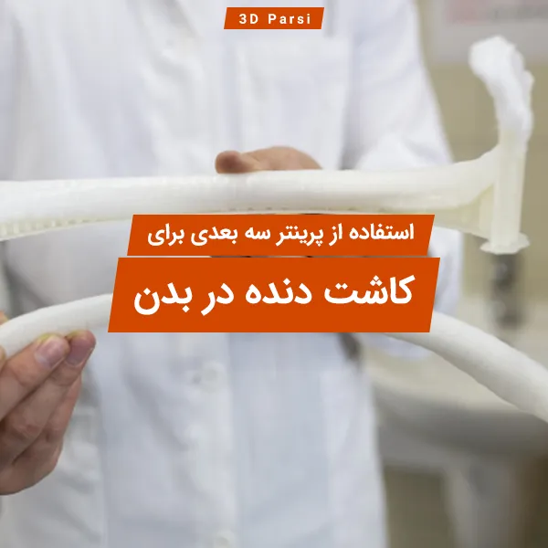 کاشت دنده در بدن با پرینت سه بعدی